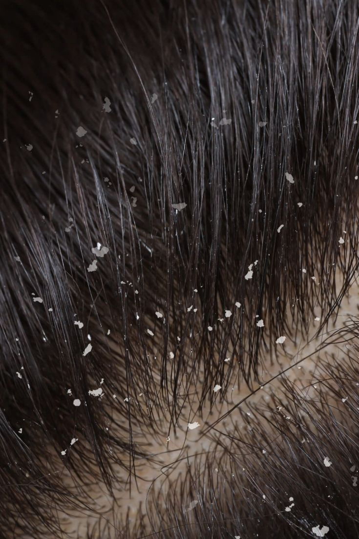 RUTINA CAPILAR ANTICASPA