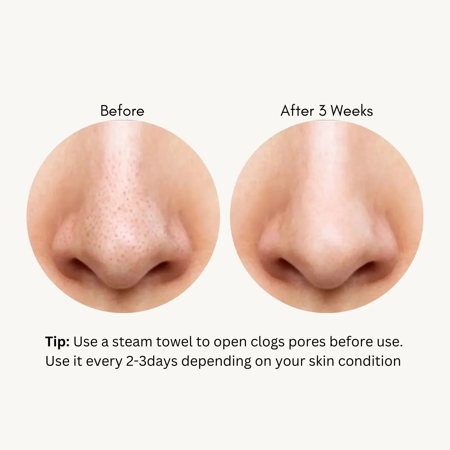 TONYMOLY Takopore Blackhead Scrub Stick NAZ Beauty Shop Panama