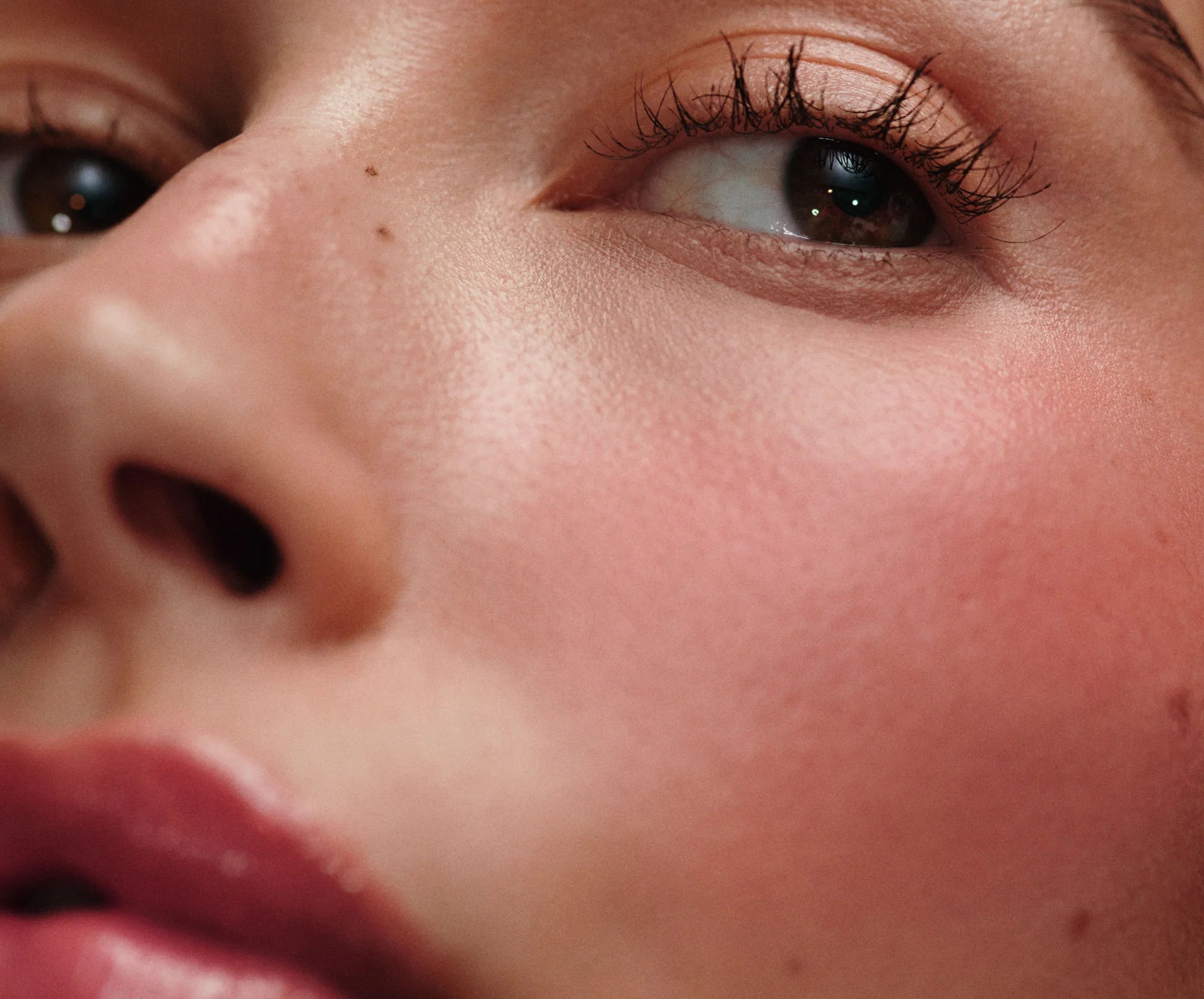 Freckle-Hero-2_Desktop_2000x_c2dae6c2-718d-4c2b-b566-666cf8c7a6f9.webp