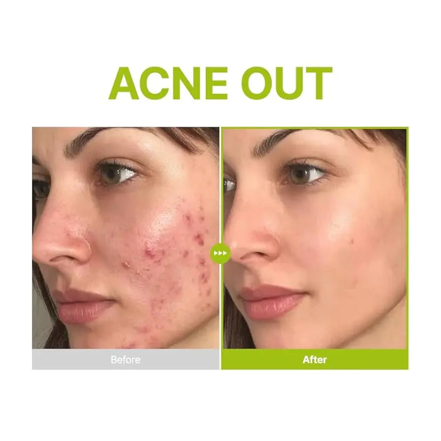 PURITO Azelaic Acid 10 Kojic Tea Tree Serum NAZ Beauty Shop Panama