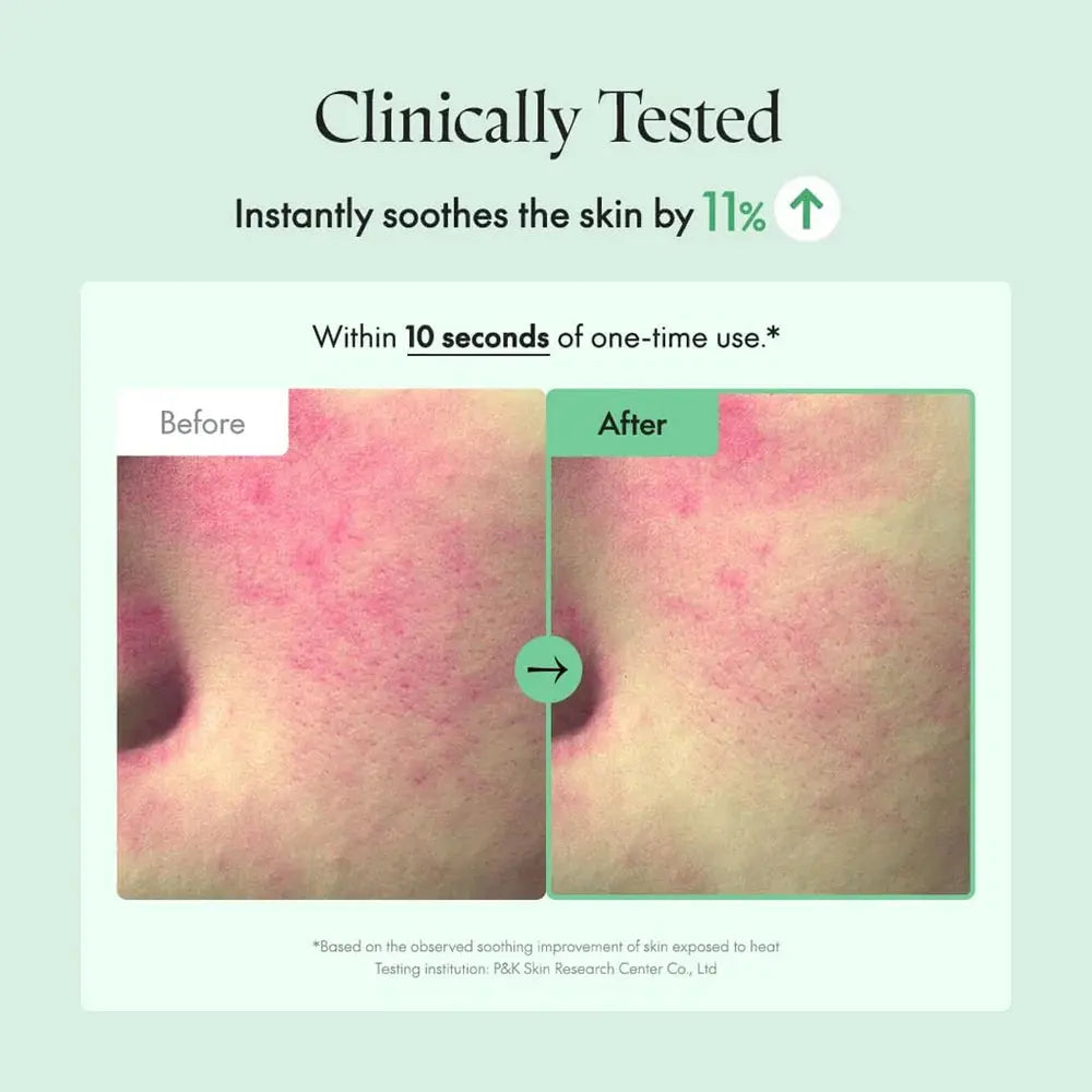 PURITO Wonder Releaf Centella Toner – efecto calmante 10 segundos reduce rojeces 26% vegano comprar en NAZ Beauty Shop Panama