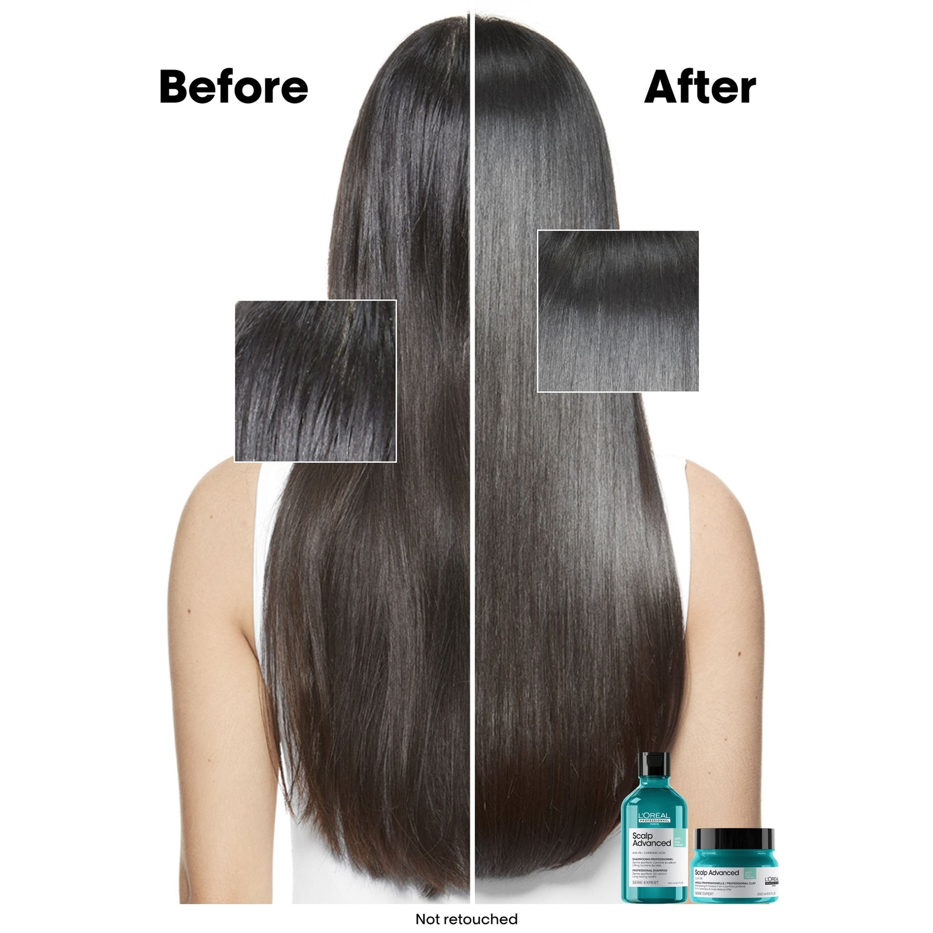 L'Oréal Professionnel Scalp Dermo-Clarifier Shampoo 300ml vista lateral del envase