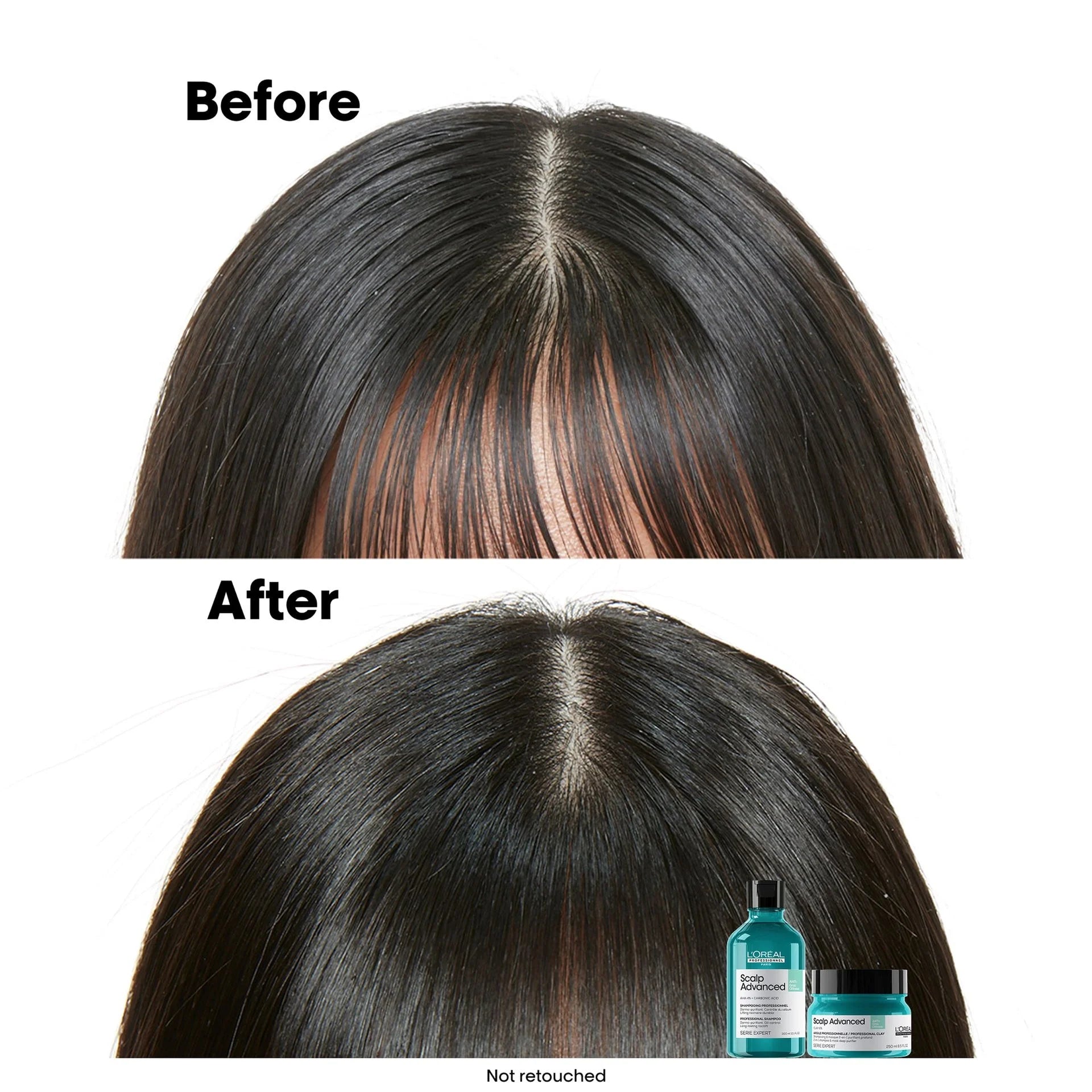 L'Oréal Professionnel Scalp Dermo-Clarifier Shampoo modo de uso y aplicación