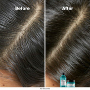 Tecnología Scalp Dermo-Clarifier L'Oréal Professionnel para cuero cabelludo graso