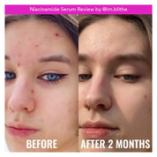 GOOD MOLECULES Niacinamide Serum NAZ Beauty Shop Panama